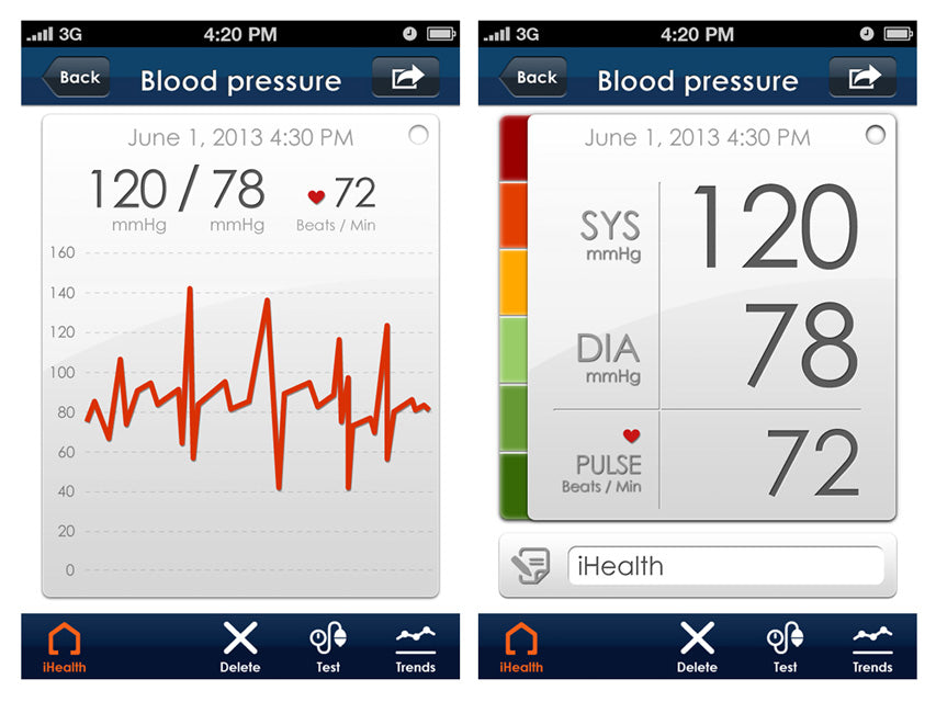 IHealth BP5 Arm Intelligentes Blutdruckmessgerät, iPad-kompatibel, Professionelles drahtloses Bluetooth-Herz-Kreislauf-Monitoring